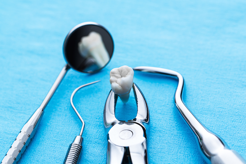 phẫu thuật hàm mặt oral surgery tại assure dental